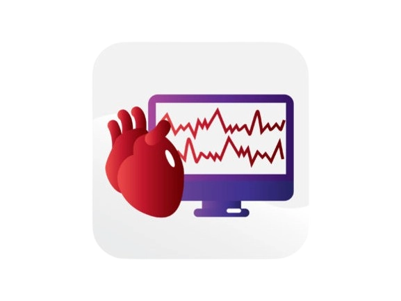  ECG-Electrocardiogram 